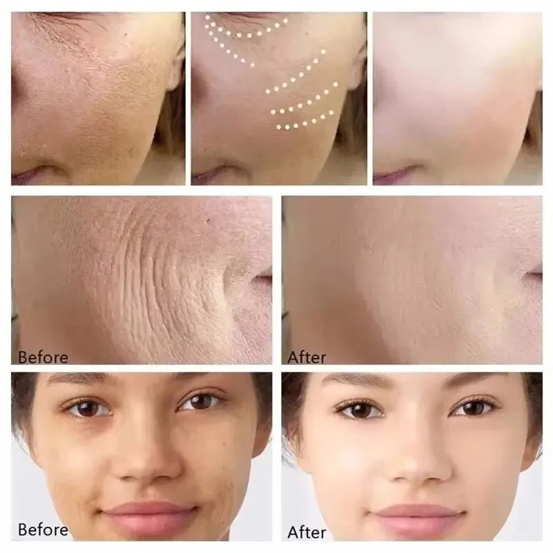 Eliminador instantáneo de arrugas, suero facial reafirmante que se desvanece, líneas finas, esencia antienvejecimiento, blanqueamiento, ilumina, nutre el cuidado de la piel
