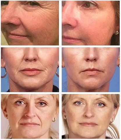 Eliminador instantáneo de arrugas, suero facial reafirmante que se desvanece, líneas finas, esencia antienvejecimiento, blanqueamiento, ilumina, nutre el cuidado de la piel