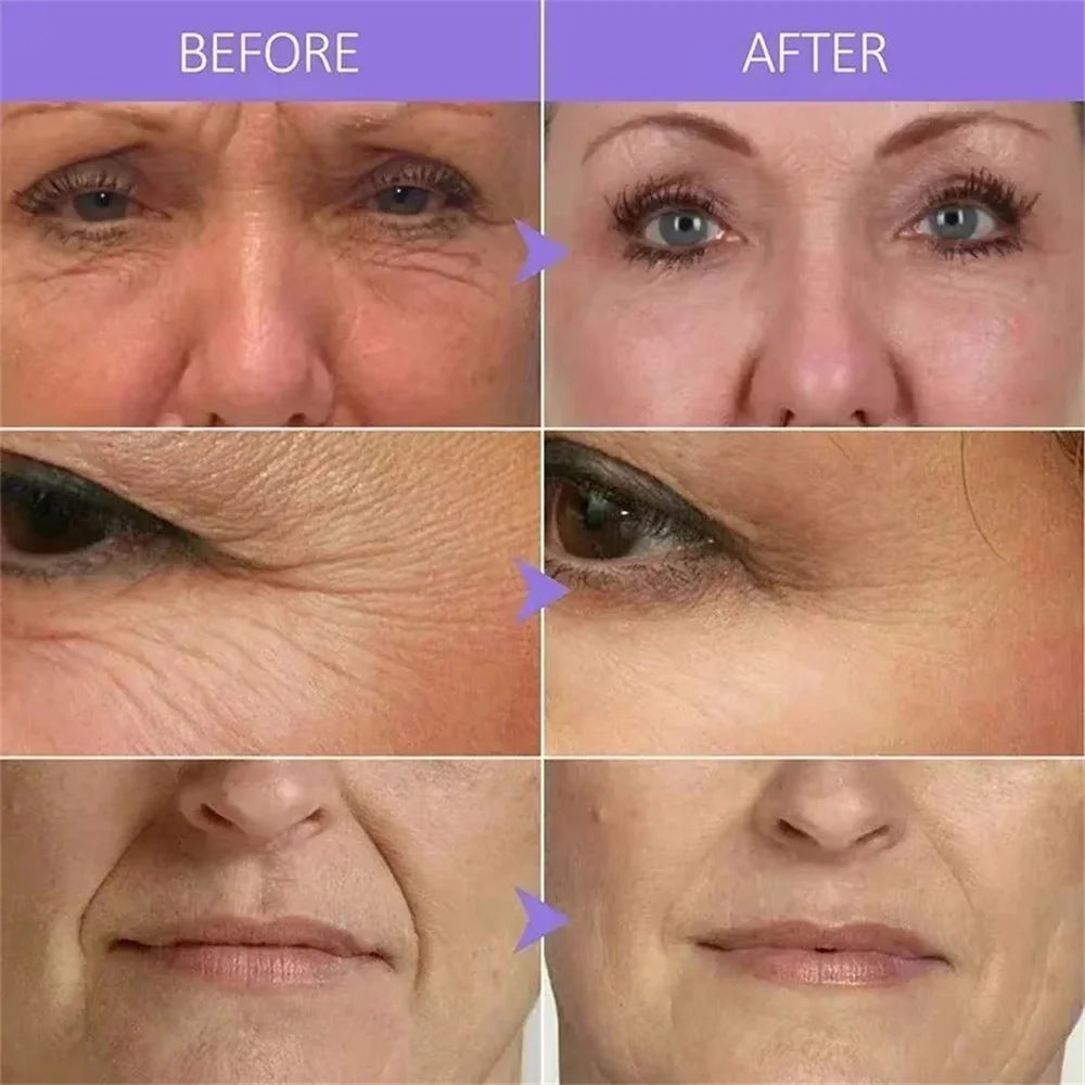Eliminador instantáneo de arrugas, suero facial reafirmante que se desvanece, líneas finas, esencia antienvejecimiento, blanqueamiento, ilumina, nutre el cuidado de la piel